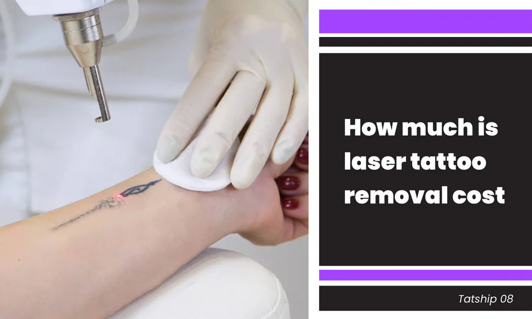 How Much Is Laser Tattoo Removal Cost Guide