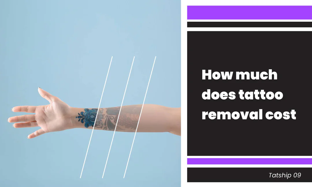 How Much Does Tattoo Removal Cost?