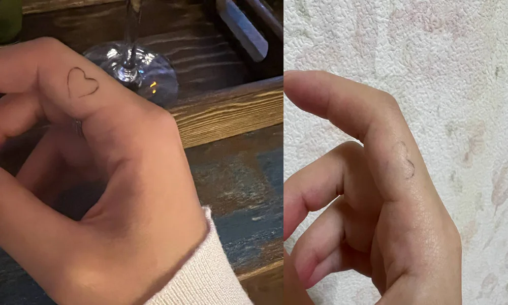 Faded heart tattoo on the side of a finger, showing the tattoo's gradual fading over time from two different angles