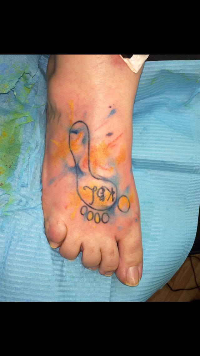Down syndrome awareness