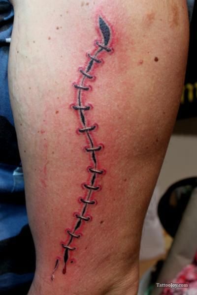 Cover scars
