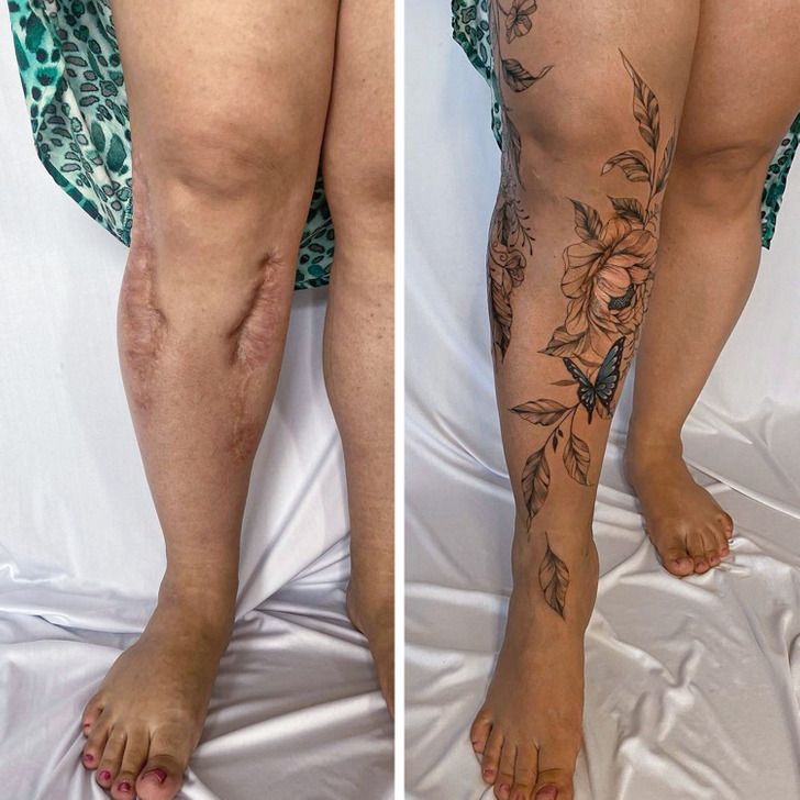 15 Scars That Were Turned Into Works of Art and Are Worthy of Being Shown  Off