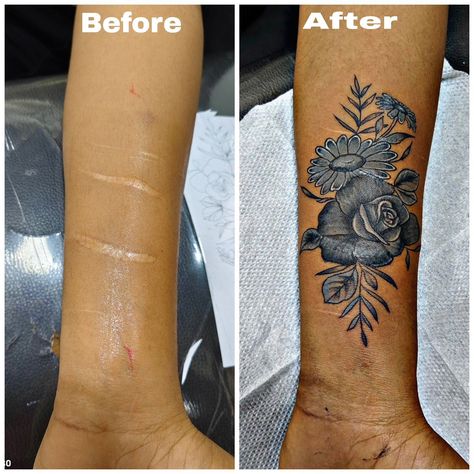 Leg Scar Tattoo