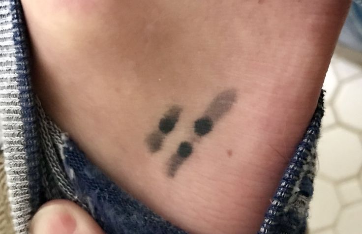 My daughter has translocation trisomy 21. It is a form of Down syndrome.  This is a tattoo that I got on my lower ankle of her karyotype. Her third  21st hopped onto