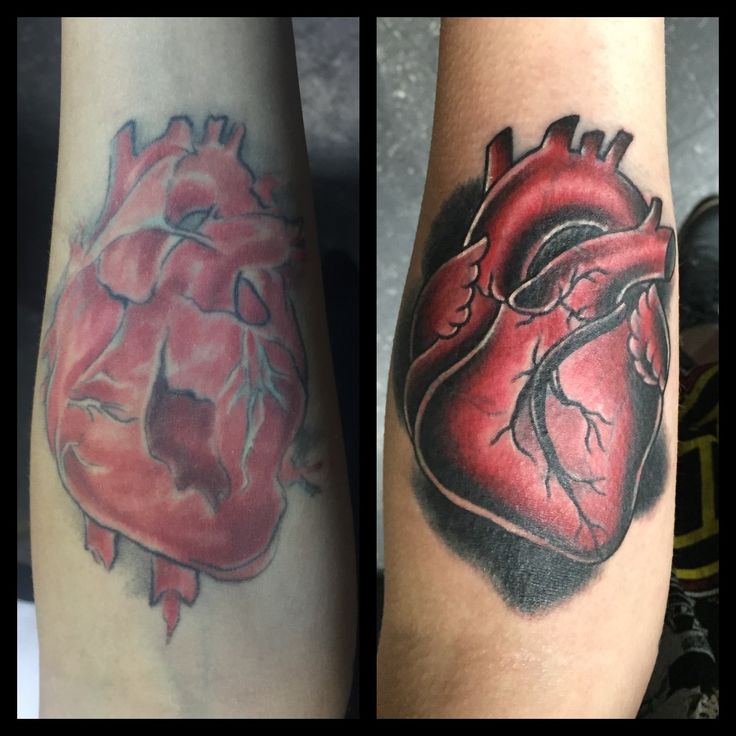 Anatomical Heart Tattoo: Before & After the Cover Up Job
