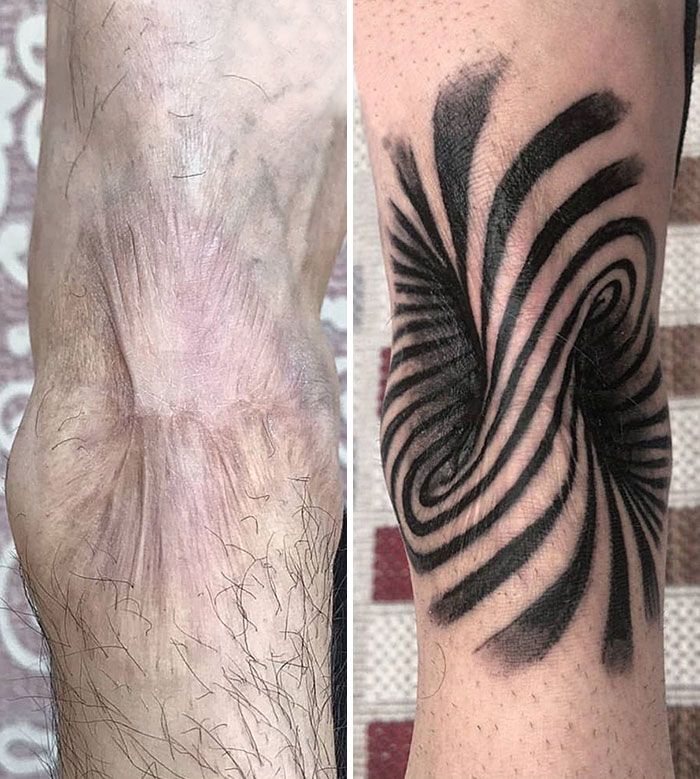 Scar Tattoo