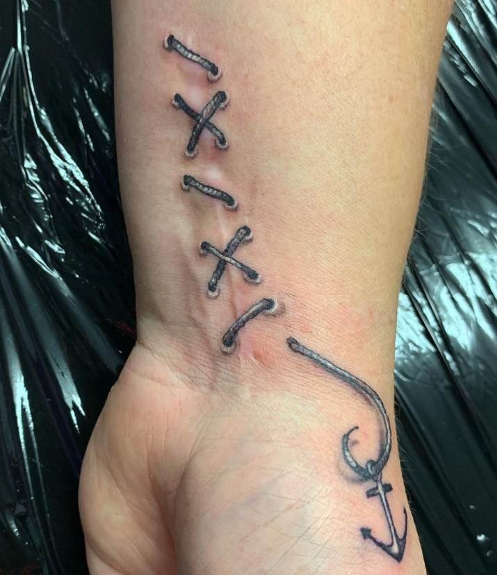 Fixing a Bad Tattoo